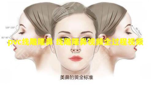 pvc线雕隆鼻 线雕隆鼻视频全过程视频